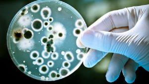 ميكروبات مقاومة للمضادات الحيوية تهدد البشرية