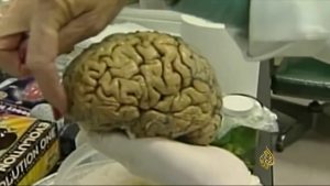 بالفيديو .. تحديد الجزء المسؤول عن البخل و الكرم في المخ