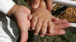 طفل أمريكي يحتفل بالذكرى الأولى لـ ” زراعة يديه “