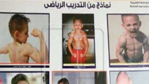 مدرسة مصرية تخدع مسؤول حكومي بصور طفل روماني من موسوعة ” غينيس ” ! ( فيديو )