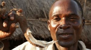 مشعوذ مالاوي مصاب بـ ” الإيدز ” يمارس الجنس مع أكثر من 100 سيدة
