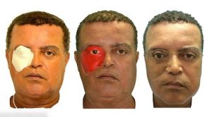البرازيل : زراعة وجه لخمسيني بفضل تطبيق مجاني على هاتف محمول