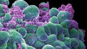 تقنية جديدة قد تقضي على الخلايا السرطانية بـ 10 أيام