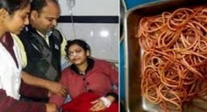 بالفيديو .. جراحون يستخرجون 150 دودة حية من معدة شابة هندية