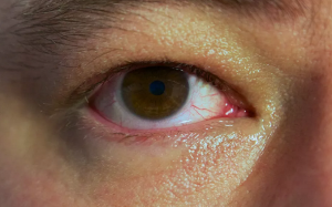 باحثون : التحديق مطولاً في شاشات الكمبيوتر يجهد العينين و لا يسبب العمى