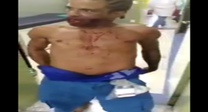 بالفيديو .. هذا ما يفعله ضحايا إطلاق النار في مستشفيات البرازيل