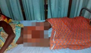 في نيجيريا .. عائلة تخطف مغتصب طفلتها و تعاقبه بحرق عضوه الذكري