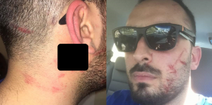 لبنان : مخرج لبناني يدعي تعرضه للضرب على يد سوريين اثنين ما أدى لنقله إلى المستشفى ( صور )