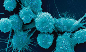 علماء : ثمة أجسام مضادة قادرة على محاربة السرطان