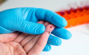 باحثون يطورون اختبار جديد للدم لا يحتاج اكثر من قطرة واحدة