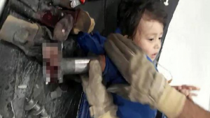 تركيا : رجال إطفاء يساعدون أطباء في إخراج يد طفل تهشمت داخل ” ماكينة لفرم اللحوم ” ( فيديو )