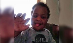 بسبب مرض نادر .. طفل أمريكي تصل يده إلى خمسة أضعاف حجمها ( فيديو )