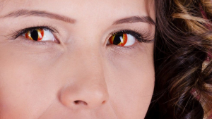 متخصصون : العدسات اللاصقة التنكرية قد تسبب فقدان البصر
