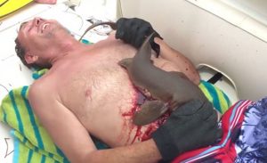 بالفيديو .. قرش يغرز أسنانه متشبثاً بـ ” بطن ” رجل أمريكي