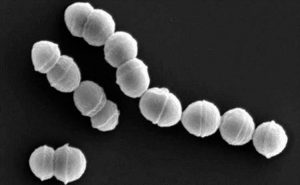 ” بكتيريا ” تقتل ضحاياها في غضون ساعات تنتشر في اليابان