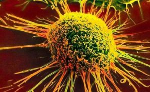 كيف تتنصر الخلايا السرطانية في معركة البقاء ؟