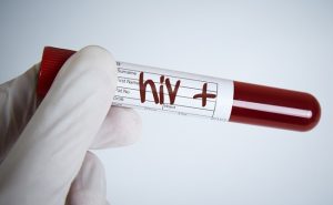 اكتشاف طبي .. تطوير دواء شامل ضد فيروس ” الإيدز “