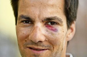 ألمانيا : عمدة مدينة انتخب حديثاً يتعرض للضرب في ” اليوم العالمي للضحك ” ( فيديو )