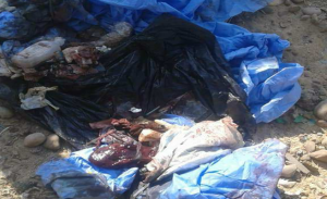 مصر : العثور على كبد و أعضاء بشرية في القمامة !
