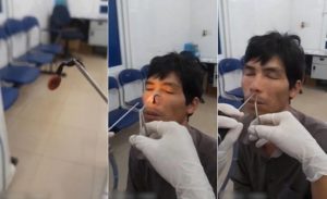 استخراج ” دودة ماصة للدم ” من أنف رجل فيتنامي !