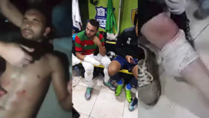 مشاهد صادمة خلال مباراة كرة قدم في الجزائر ( فيديو )