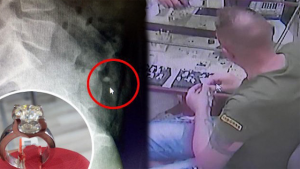 تركيا : القبض على سائح ابتلع خاتماً ماسياً قيمته عشرات الآلاف من الدولارات بغرض سرقته ! ( فيديو )