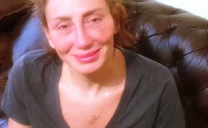 ريهام سعيد تحكي عن إصابتها بـ ” مثلث الموت ” و إزالة أنفها بالكامل ! ( فيديو )