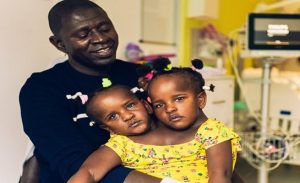 السنغال : والد توأمتان ملتصقتان أمام خيارين أحلاهما مر ( فيديو )